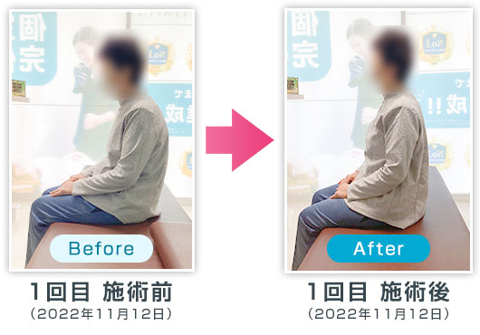ビフォーアフター